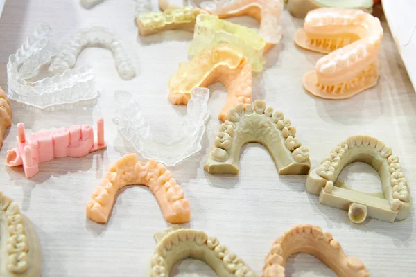 Impressions of teeth on a dental 3D scanner
