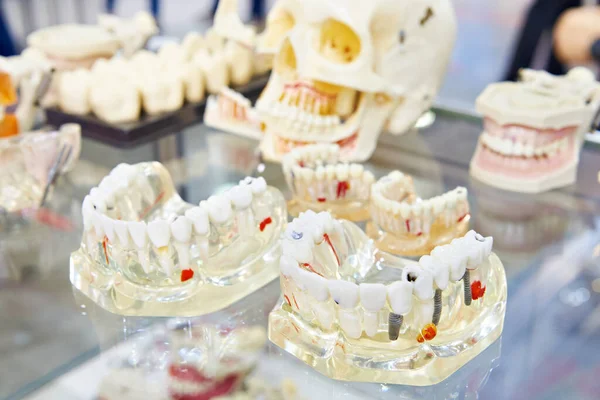 Zubní Makety Zubní Prodejně Výstava — Stock fotografie