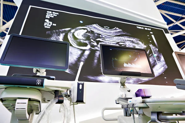 Ultrasonik Tıbbi Cihaz Yatak — Stok fotoğraf