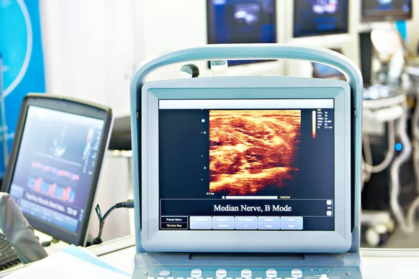 Экран Портативного Медицинского Ультразвукового Аппарата — стоковое фото