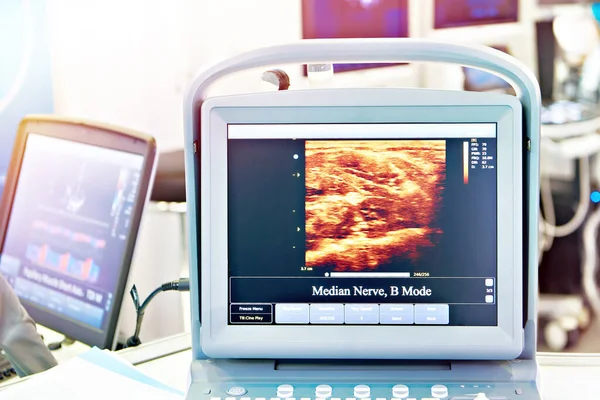 Екран Портативної Медичної Ультразвукової Машини — стокове фото