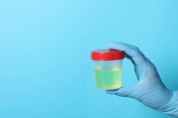 Arzt Handschuhfach Mit Urinprobe Zur Analyse Auf Hellblauem Hintergrund Nahaufnahme — Stockfoto