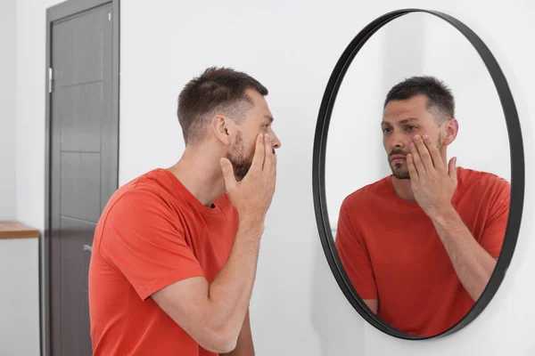 Dormir Homem Privado Olhando Para Mesmo Espelho Dentro Casa — Fotografia de Stock
