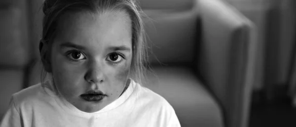 Маленькая Девочка Синяками Лице Дома Место Смс Жертва Домашнего Насилия — стоковое фото