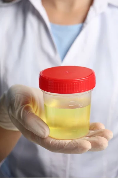 Médecin Tenant Récipient Avec Échantillon Urine Pour Analyse Gros Plan — Photo
