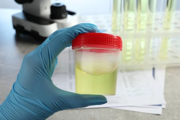 Doctor Holding Container Urine Sample Analysis Grey Table Laboratory Closeup — Stock Photo, Image