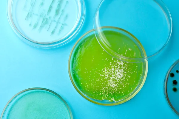 Boîtes Pétri Avec Différentes Colonies Bactéries Sur Fond Bleu Clair — Photo