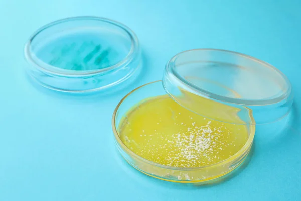 Petri dishes with different bacteria colonies on light blue background, closeup