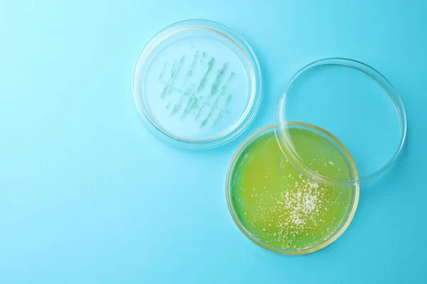 Petriho Misky Různými Koloniemi Bakterií Světle Modrém Pozadí Ploché Ležely — Stock fotografie