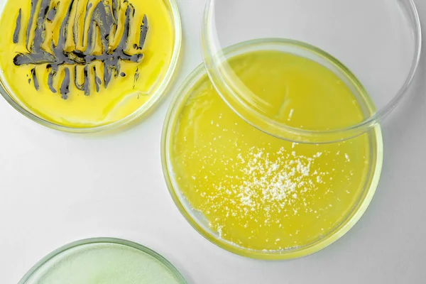 stock image Petri dishes with different bacteria colonies on white background, flat lay