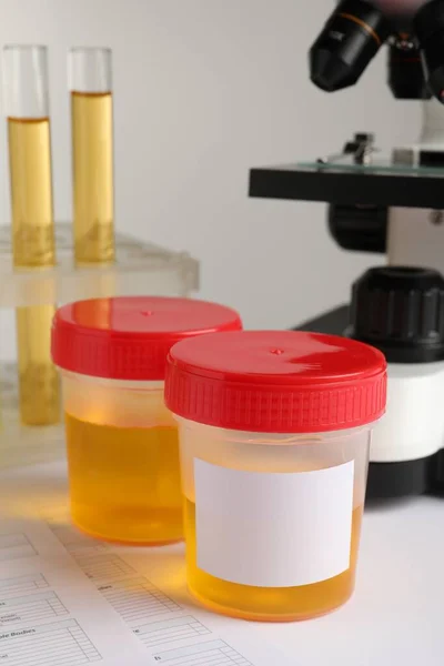 Behälter Mit Urinproben Zur Analyse Auf Dem Tisch Labor — Stockfoto