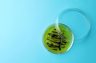 Açık mavi arka planda bakteri kolonisi olan petri kabı, üst manzara. Metin için boşluk