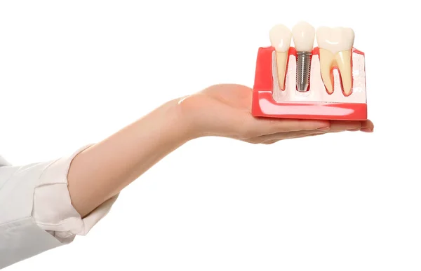 stock image Dentist holding educational model of dental implant on white background, closeup