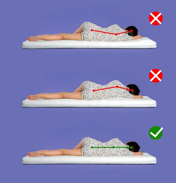 有女人躺在床垫上的照片的学院 错误和正确的睡眠姿势 选择合适的床垫 — 图库照片
