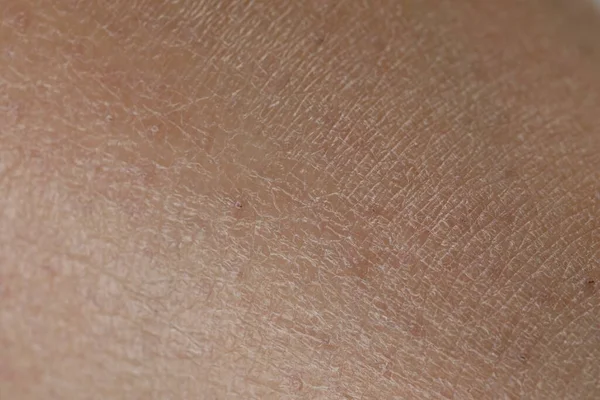 Closeup Άποψη Του Ξηρού Δέρματος Φόντο — Φωτογραφία Αρχείου