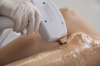 Woman undergoing laser epilation procedure in beauty salon, closeup