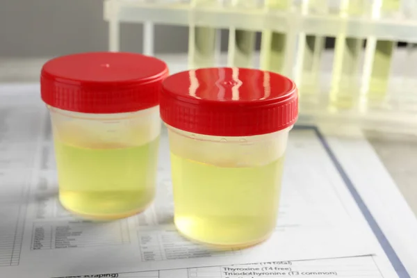 Recipienti Con Campione Urina Analisi Modulo Prova Sul Tavolo Laboratorio — Foto Stock