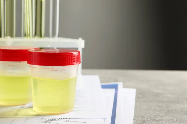 Behälter Mit Urinprobe Für Analyse Und Testform Auf Grauem Tisch — Stockfoto