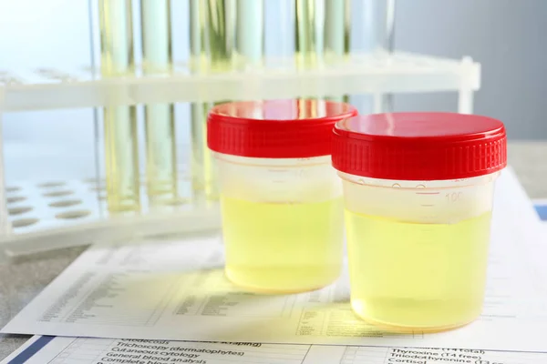 Containers Urine Sample Analysis Test Form Table Laboratory Closeup — Stock Photo, Image