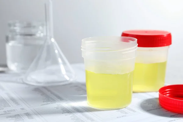 Behälter Mit Urinproben Zur Analyse Und Glaswaren Auf Testformularen Labor — Stockfoto