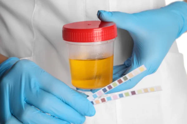 Krankenschwester Hält Teststreifen Und Behälter Mit Urinprobe Zur Analyse Nahaufnahme — Stockfoto