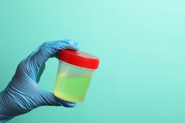 Dokter Memegang Wadah Dengan Sampel Urin Untuk Analisis Latar Belakang — Stok Foto