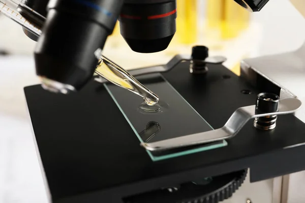 Microscoop Met Urinedruppel Glazen Glaasje Close — Stockfoto