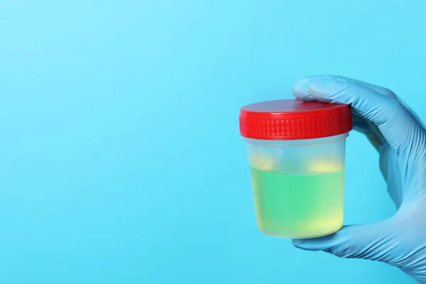 Dokter Memakai Sarung Tangan Memegang Wadah Dengan Sampel Urin Untuk — Stok Foto