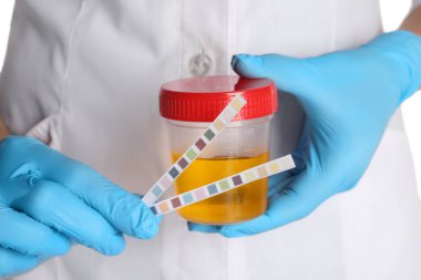 Analiz için idrar örneği içeren test bantları ve kontlarını tutan hemşire, yakın plan.