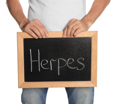 Beyaz arka planda Herpes kelimesinin yazılı olduğu küçük yazı tahtası tutan adam, yakın plan.