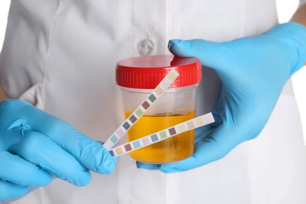 Verpleegkundige Houder Teststrips Container Met Urinemonster Voor Analyse Close — Stockfoto