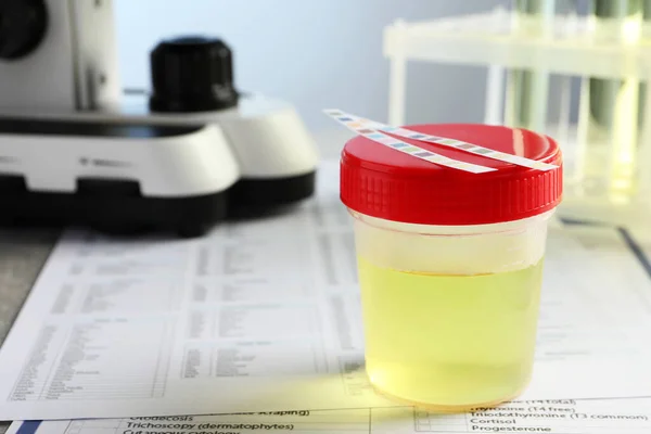 Behälter Mit Urinprobe Zur Analyse Von Testformen Labor Nahaufnahme — Stockfoto