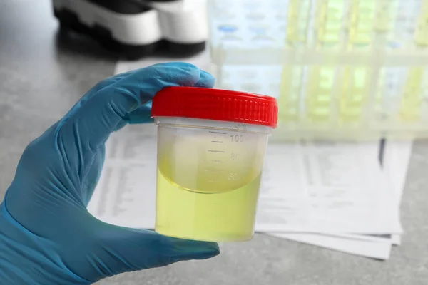 Médecin Tenant Récipient Avec Échantillon Urine Pour Analyse Table Grise — Photo