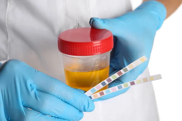 Perawat Memegang Strip Tes Dan Wadah Dengan Sampel Urin Untuk — Stok Foto