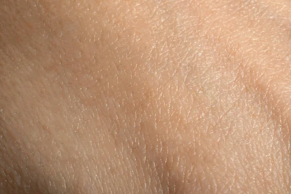 Closeup View Dry Human Skin Background — Stock Photo, Image