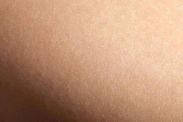 乾燥した人間の皮膚を背景としてのクローズアップ — ストック写真