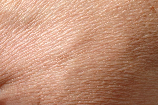 Closeup Άποψη Του Ξηρού Ανθρώπινου Δέρματος Φόντο — Φωτογραφία Αρχείου