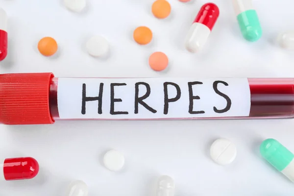 stock image Test tube with word Herpes and different pills on white background, closeup