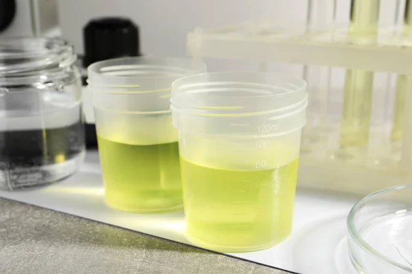 Conteneurs Avec Échantillons Urine Pour Analyse Verrerie Sur Table Grise — Photo