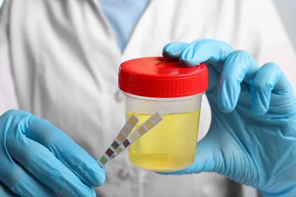 Médecin Contenant Avec Échantillon Urine Des Bandelettes Essai Pour Analyse — Photo