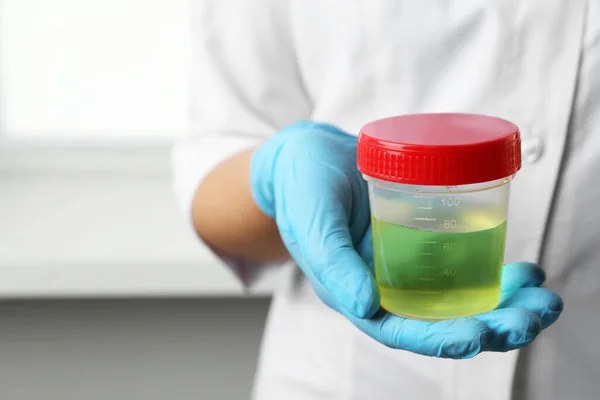 Docteur Contenant Avec Échantillon Urine Pour Analyse Intérieur Gros Plan — Photo