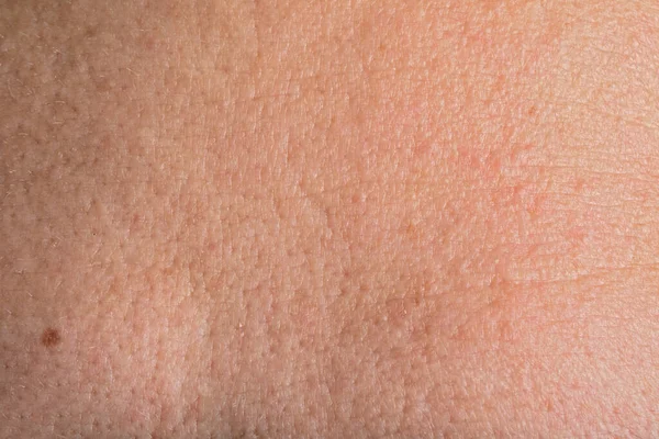 Closeup View Human Skin Background — Stock Photo, Image