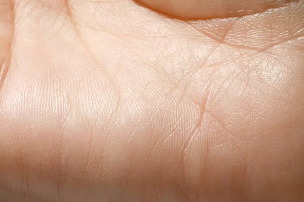Kuru Ciltli Insan Elinin Yakın Görüntüsü — Stok fotoğraf