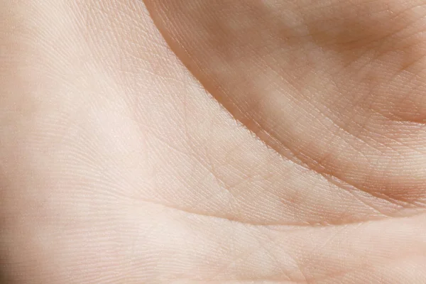 皮肤干的人的手的合影 — 图库照片