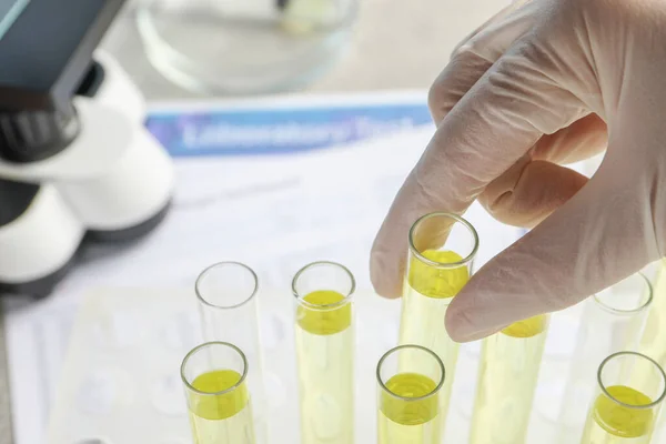 Médecin Prenant Une Éprouvette Avec Échantillon Urine Pour Analyse Table — Photo