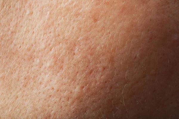 인간의 피부를 배경으로 클로즈업 — 스톡 사진
