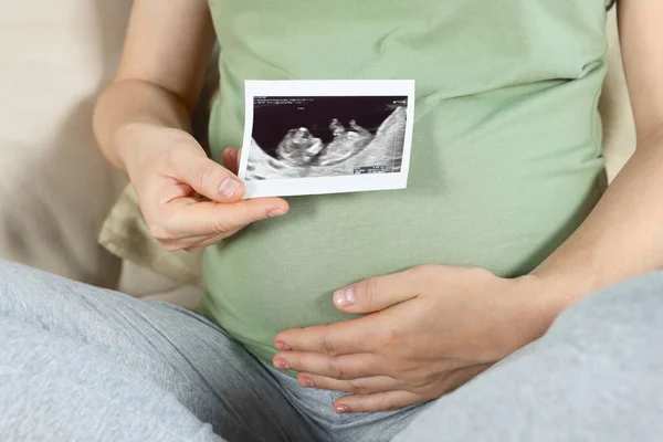 Bebeğin Ultrason Fotoğrafı Olan Hamile Bir Kadın Yakın Plan — Stok fotoğraf