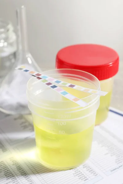 Pojemniki Próbkami Moczu Analizy Wyrobami Szklanymi Formularzach Testowych Laboratorium — Zdjęcie stockowe