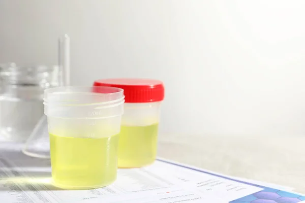 Behälter Mit Urinproben Zur Analyse Und Glaswaren Auf Testformularen Vor — Stockfoto