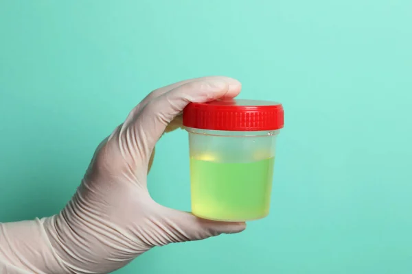 Arzt Hält Behälter Mit Urinprobe Zur Analyse Auf Türkisfarbenem Hintergrund — Stockfoto